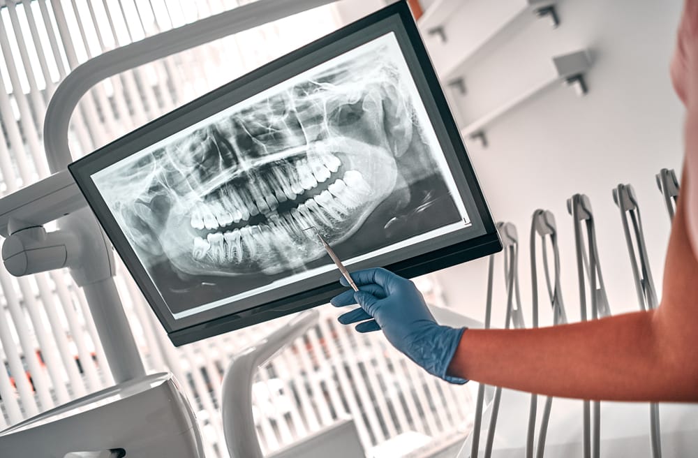 What Is An OPG Dental X Ray? | Localsearch